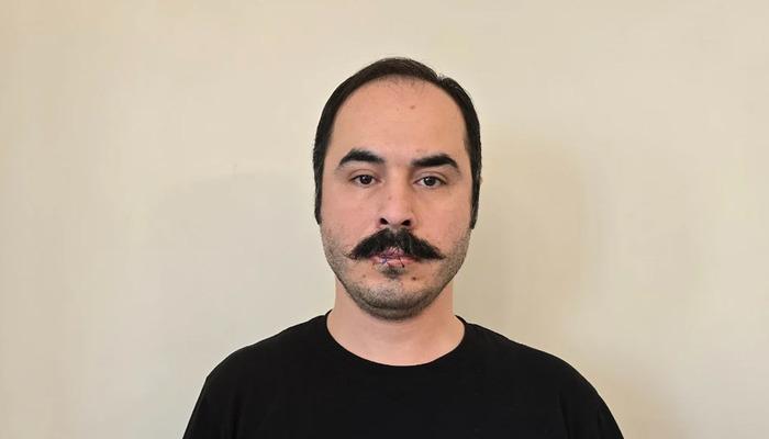 İğne iplik alıp dudaklarını dikti! Hüseyin Roneki tüm dünyaya duyurdu: "Mühürlü kalacak"